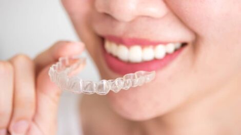 6-month braces treatment