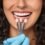 Porcelain Veneers in Miami