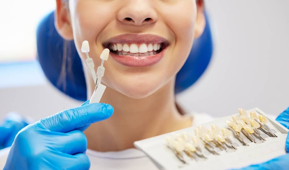 porcelain veneers Miami